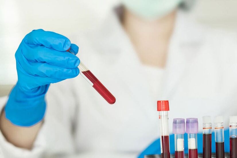 É possível beber álcool antes de doar sangue